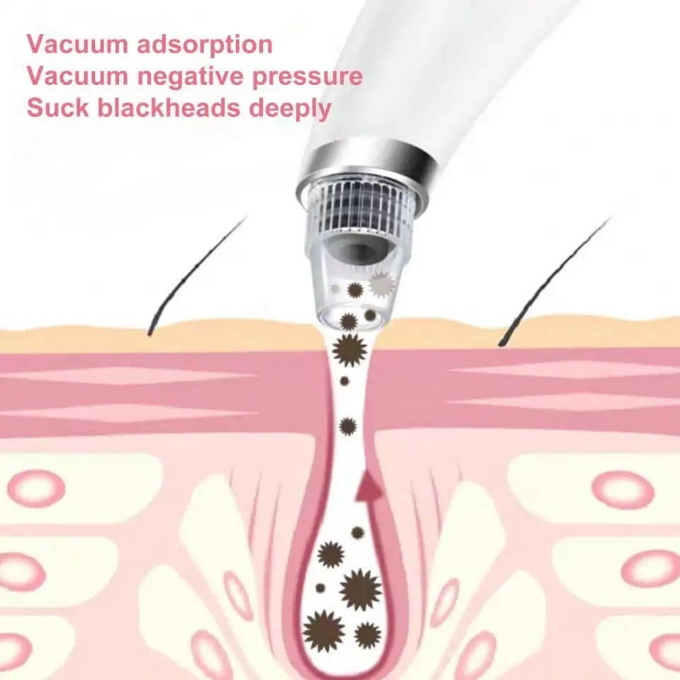 Black Spot Suction Vacuum, Blackhead Remover Cleaning Device, Electric Facial Pore Cleaner, Skincare Exfoliating Beauty Device, Facial Pore Acne Pimple Cleaner, Facial Tag Vacuum Suction, Household Professional Facial Pore Pimple Cleanser Black Spot Suction Vacuum, Blackhead Remover Cleaning Device, Electric Facial Pore Cleaner, Skincare Exfoliating Beauty Device, Facial Pore Acne Pimple Cleaner, Facial Tag Vacuum Suction, Household Professional Facial Pore Pimple Cleanser